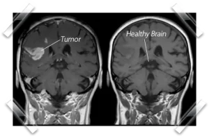 Meridian Health Protocol Benefits